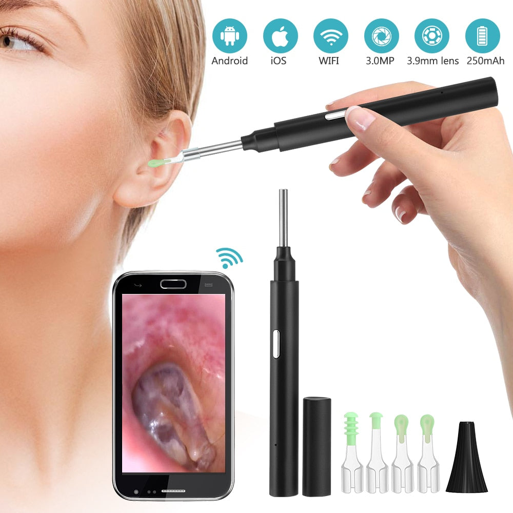 WiFi Ear Wax Remover