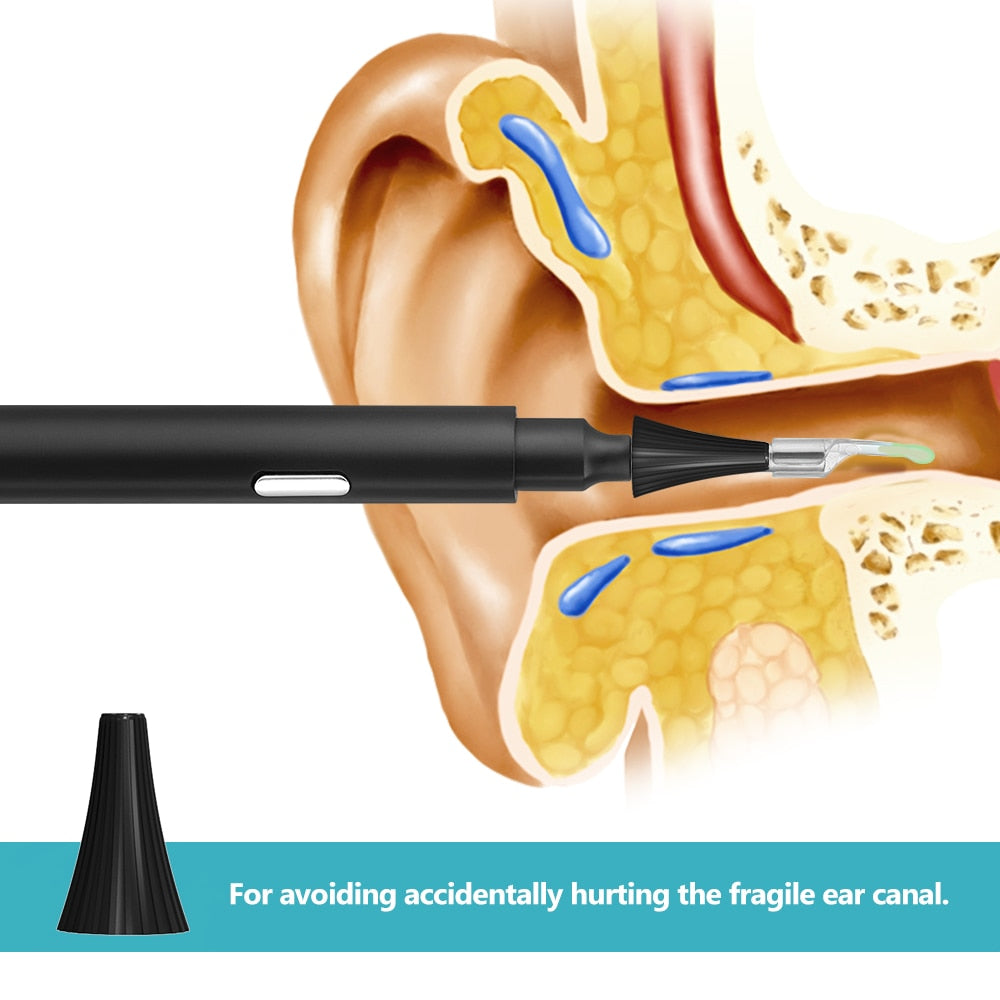 WiFi Ear Wax Remover