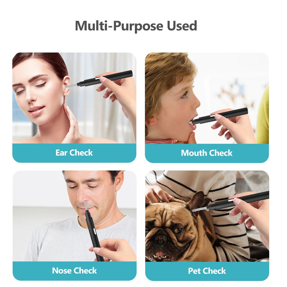 WiFi Ear Wax Remover