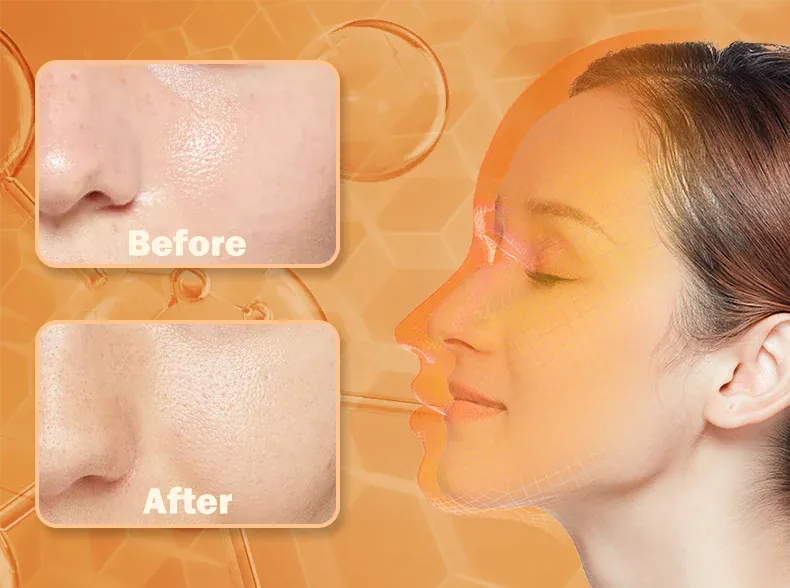 4 Colors Silicone LED Face Mask LED 4 Colors Silicone LED Face Mask LED