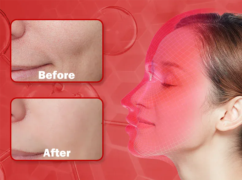 4 Colors Silicone LED Face Mask LED 4 Colors Silicone LED Face Mask LED