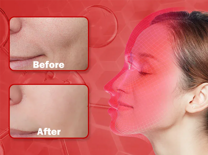 4 Colors Silicone LED Face Mask LED 4 Colors Silicone LED Face Mask LED