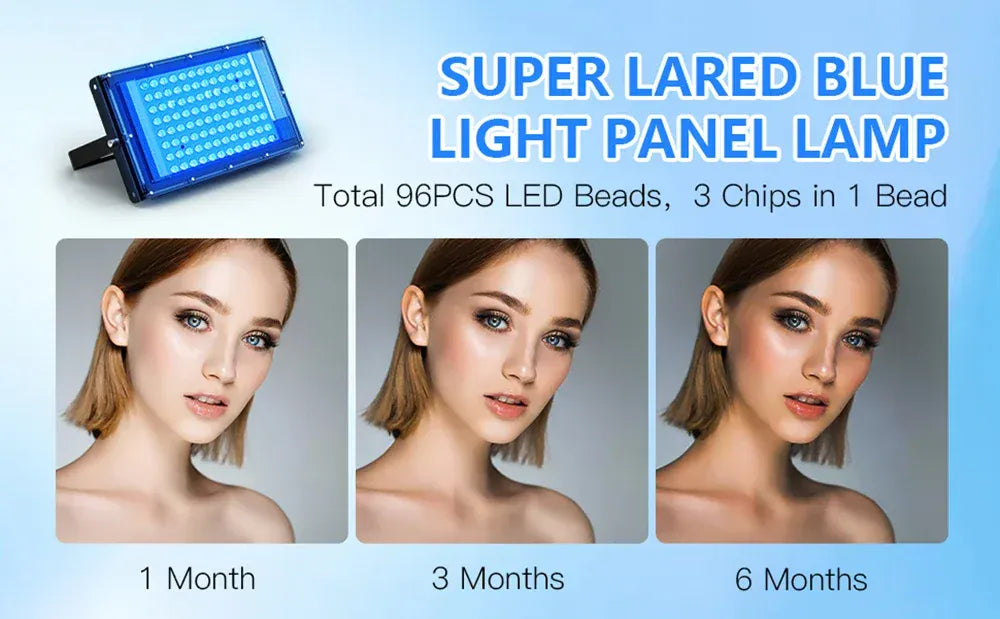 50W Blue Light Therapy Lamp with Tripod | 420 LEDs, 460nm & 490nm Skin Care — Wahooly 50W Blue Light Therapy Lamp with Adjustable Tripod | 420 LEDs | 460nm & 490nm Skin Care & Tanning Solarium