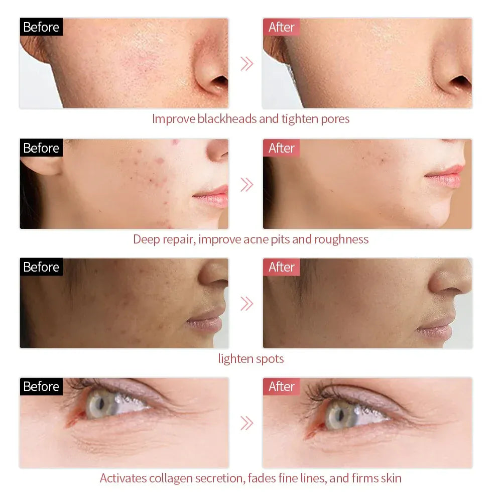 7 Colors LED Face Beauty Machine Red Light Therapy 7 Colors LED Face Beauty Machine Red Light Therapy