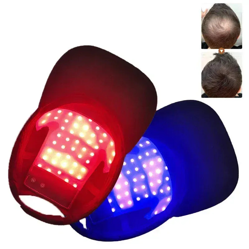 LED Red Light Therapy Cap Hair Growth Helmet Diode LaserHat Light Therapy Cap for Hair Regrowth and Hair Loss Treatment LED Red Light Therapy Cap Hair Growth Helmet Diode LaserHat Light Therapy Cap for Hair Regrowth and Hair Loss Treatment