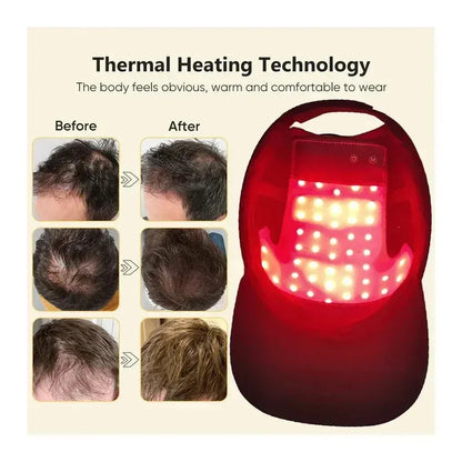 LED Red Light Therapy Cap Hair Growth Helmet Diode LaserHat Light Therapy Cap for Hair Regrowth and Hair Loss Treatment LED Red Light Therapy Cap Hair Growth Helmet Diode LaserHat Light Therapy Cap for Hair Regrowth and Hair Loss Treatment