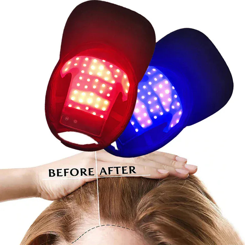 LED Red Light Therapy Cap Hair Growth Helmet Diode LaserHat Light Therapy Cap for Hair Regrowth and Hair Loss Treatment LED Red Light Therapy Cap Hair Growth Helmet Diode LaserHat Light Therapy Cap for Hair Regrowth and Hair Loss Treatment