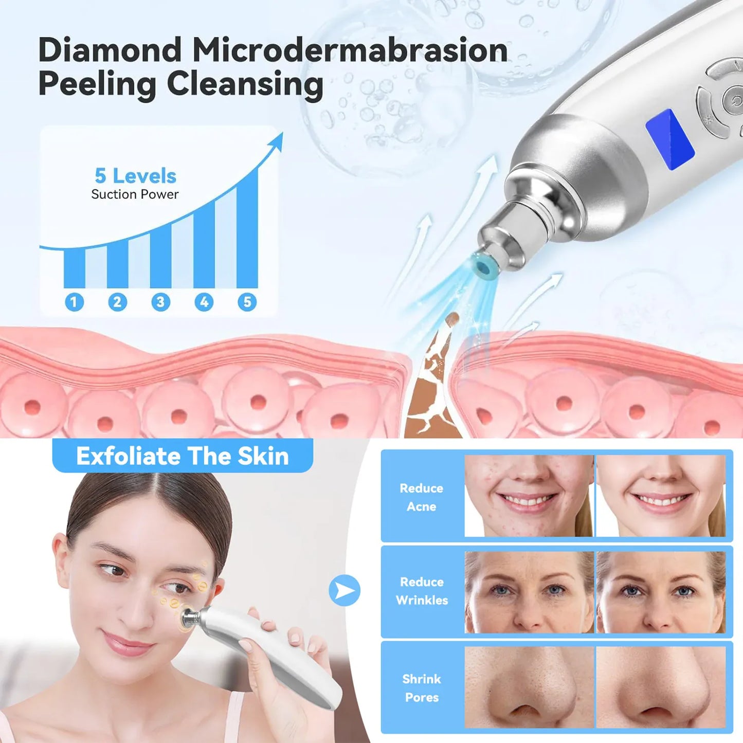 Portable Diamond Microdermabrasion Machine | Exfoliation & Blackhead Removal — Wahooly Portable Diamond Microdermabrasion Machine | Facial Exfoliation, Blackhead Removal & Skin Tightening | Rechargeable with 4 Tips
