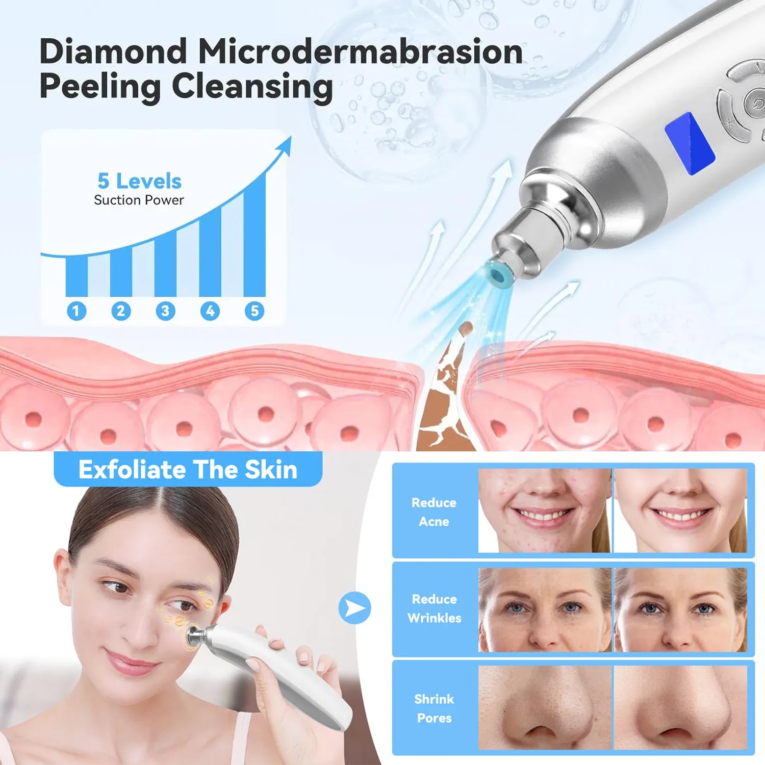Portable Diamond Microdermabrasion Machine | Exfoliation & Blackhead Removal — Wahooly Portable Diamond Microdermabrasion Machine | Facial Exfoliation, Blackhead Removal & Skin Tightening | Rechargeable with 4 Tips
