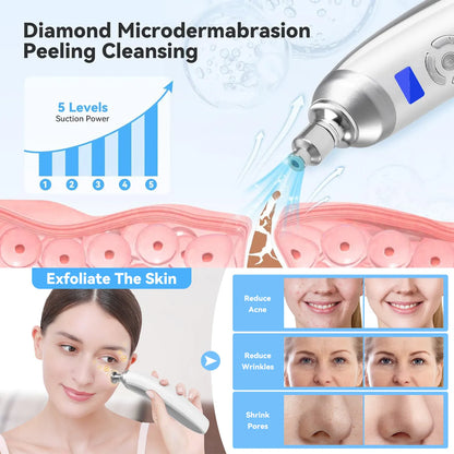 Portable Diamond Microdermabrasion Machine | Exfoliation & Blackhead Removal — Wahooly Portable Diamond Microdermabrasion Machine | Facial Exfoliation, Blackhead Removal & Skin Tightening | Rechargeable with 4 Tips