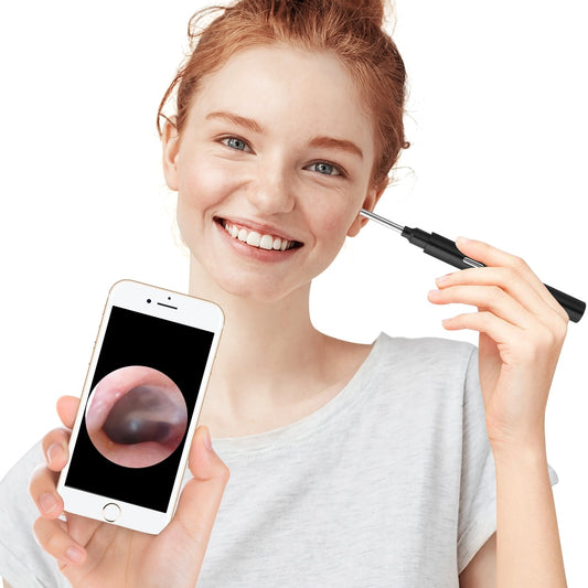 WiFi Ear Wax Remover